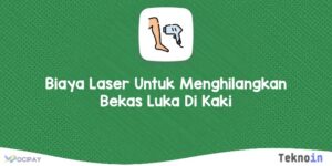 Biaya Laser Untuk Menghilangkan Bekas Luka Di Kaki